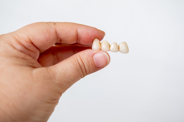 When A Dental Bridge May Be Better Than A Dental Implant