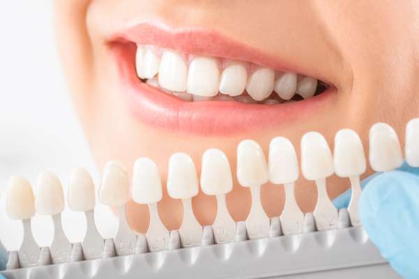 Caring For Your Dental Veneers: Tips For Long Lasting Results