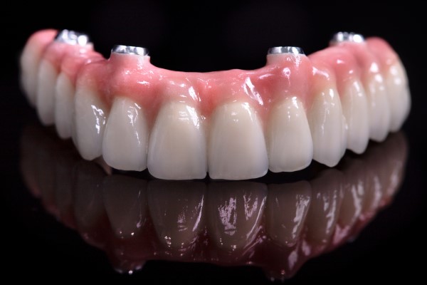 The Advantages Of Implant Supported Dentures Over Regular Ones